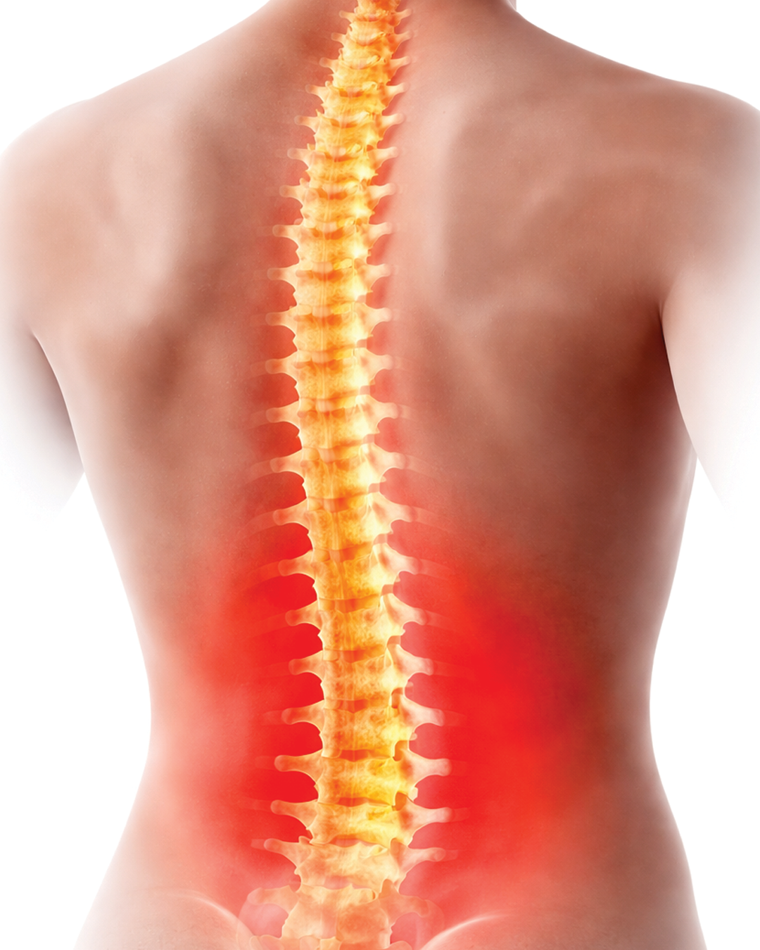 Ayurvedic Treatment for Back Pain in Coimbatore - Natural Spine Care with Holistic Healing