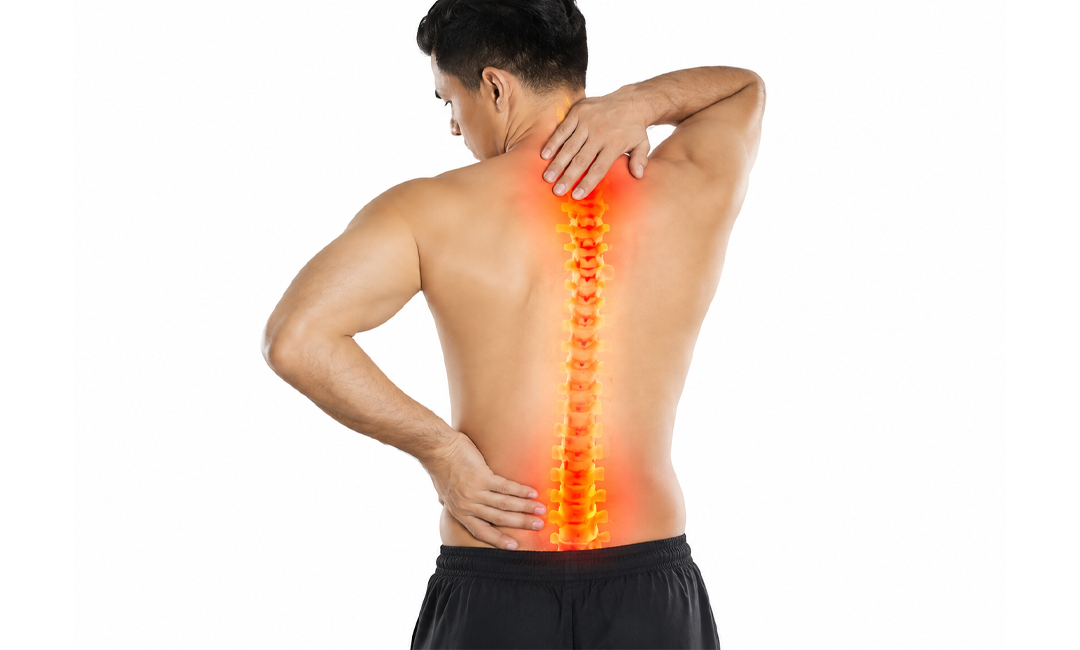Spondylitis Treatment in Coimbatore
